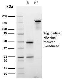 Cyclin E Monoclonal Mouse Antibody (CCNE1/2587)