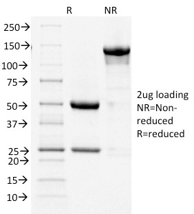Cycloxygenase-2 Monoclonal Mouse Antibody (COX2/1941)