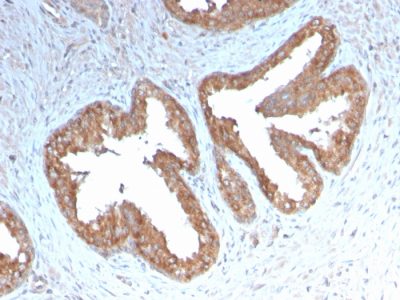 Cycloxygenase-2 Recombinant Monoclonal Rabbit Antibody (COX2/3232R)