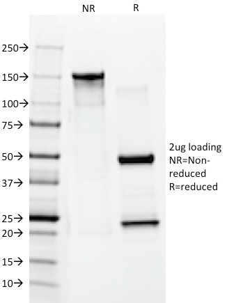 Cytokeratin 10 Monoclonal Mouse Antibody (AE20)