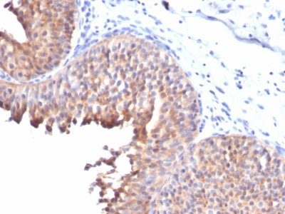 Cytokeratin 10 Monoclonal Mouse Antibody (KRT10/844)