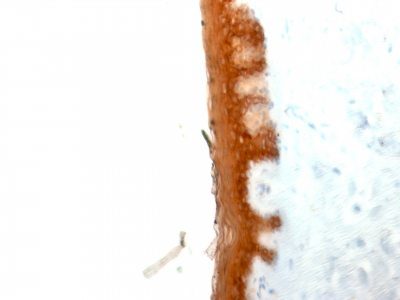 Cytokeratin 10 Monoclonal Mouse Antibody (KRT10/844)