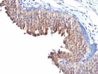 Cytokeratin 10 Monoclonal Mouse Antibody (LH2)