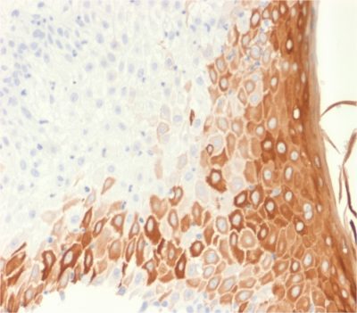 Cytokeratin 10 Recombinant Monoclonal Mouse Antibody (rKRT10/1275)