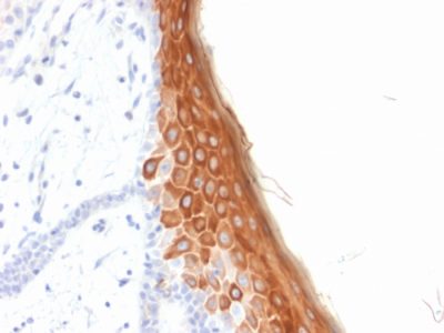 Cytokeratin 10 Recombinant Monoclonal Mouse Antibody (rKRT10/844)