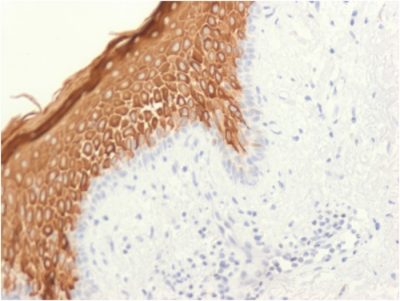 Cytokeratin 10 Recombinant Monoclonal Rabbit Antibody (KRT10/1948R)
