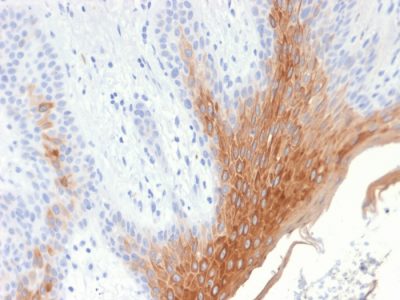 Cytokeratin 10 Recombinant Monoclonal Rabbit Antibody (KRT10/1990R)