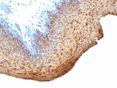 Cytokeratin 10/13 Monoclonal Mouse Antibody (DE-K13)