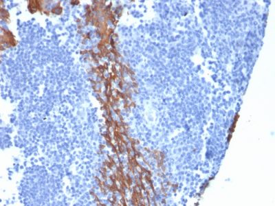 Cytokeratin 13 Monoclonal Mouse Antibody (KRT13/2213)