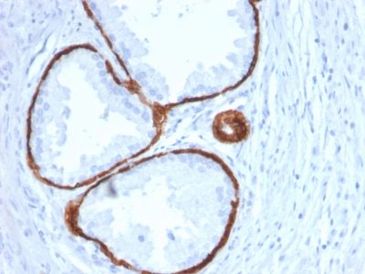 Cytokeratin 14 Monoclonal Mouse Antibody (KRT14/2375)