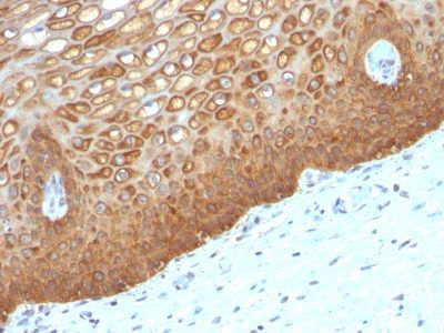 Cytokeratin 14 Monoclonal Mouse Antibody (KRT14/532)