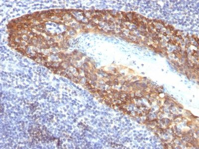 Cytokeratin 14 Monoclonal Mouse Antibody (KRT14/532)