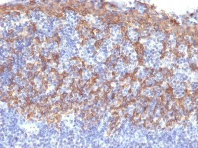 Cytokeratin 14 Monoclonal Mouse Antibody (LL002)