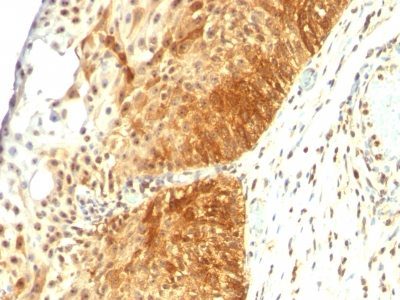 Cytokeratin 14 Monoclonal Mouse Antibody (LL002)
