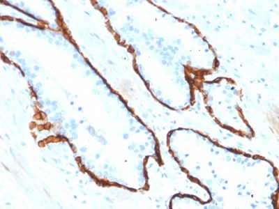Cytokeratin 15 Monoclonal Mouse Antibody (KRT15/2554)