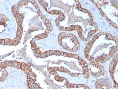 Cytokeratin 15 Monoclonal Mouse Antibody (KRT15/2957)