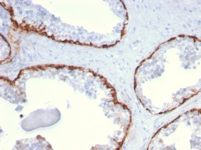 Cytokeratin 15 Monoclonal Mouse Antibody (KRT15/2959)