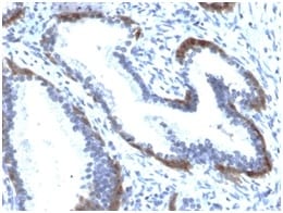 Cytokeratin 15 Recombinant Monoclonal Rabbit Antibody (KRT15/2103R)