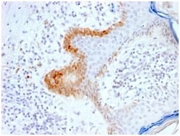 Cytokeratin 15 Recombinant Monoclonal Rabbit Antibody (KRT15/2103R)