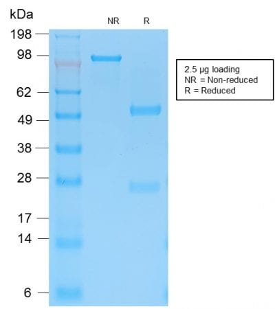 Cytokeratin 15 Recombinant Monoclonal Rabbit Antibody (KRT15/2103R)
