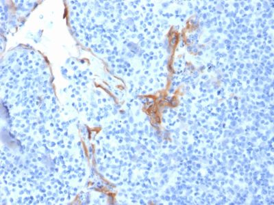 Cytokeratin 16 Monoclonal Mouse Antibody (LL025)