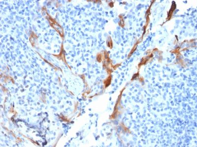 Cytokeratin 16 Recombinant Monoclonal Mouse Antibody (KRT16/1714)