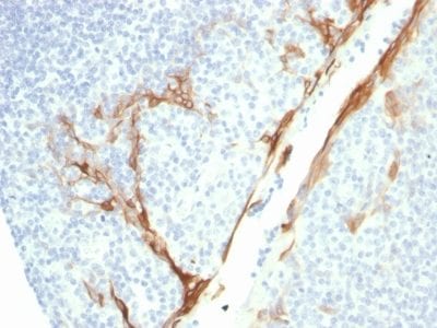 Cytokeratin 16 Recombinant Monoclonal Mouse Antibody (rKRT16/1714)