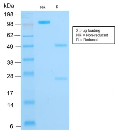 Cytokeratin 16 Recombinant Monoclonal Mouse Antibody (rKRT16/1714)