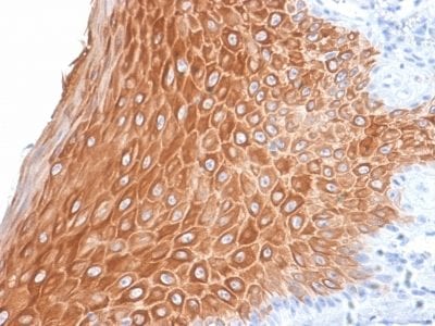 Cytokeratin 16 Recombinant Monoclonal Rabbit Antibody (KRT16/2043R)