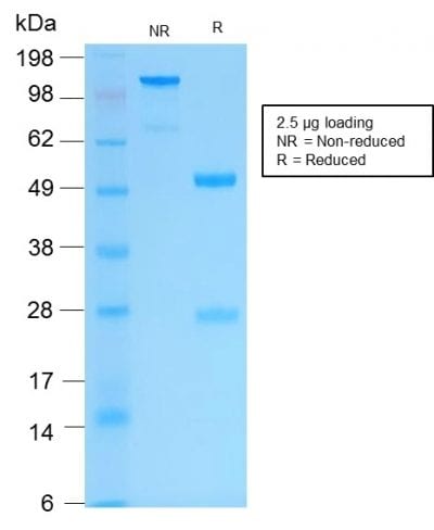 Cytokeratin 16 Recombinant Monoclonal Rabbit Antibody (KRT16/2043R)