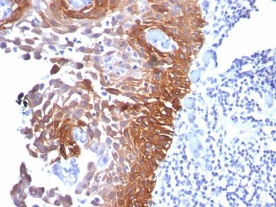 Cytokeratin 17 Monoclonal Mouse Antibody (E3)