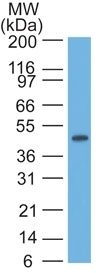 Cytokeratin 17 Monoclonal Mouse Antibody (E3)
