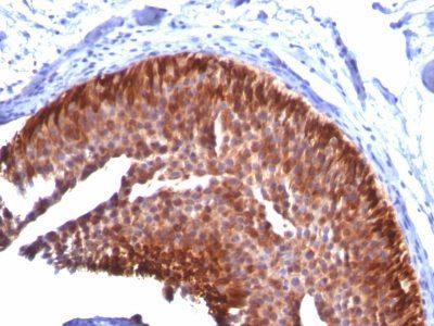 Cytokeratin 17 Monoclonal Mouse Antibody (KRT17/778)