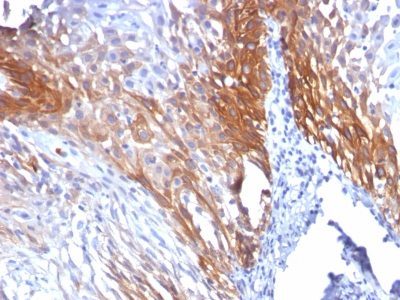Cytokeratin 17 Monoclonal Mouse Antibody (KRT17/778)