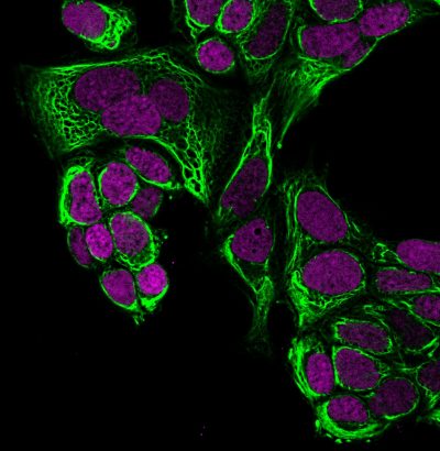 Cytokeratin 18 Monoclonal Mouse Antibody (C-04)
