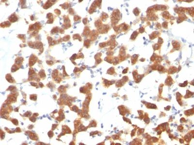 Cytokeratin 18 Monoclonal Mouse Antibody (C-04)