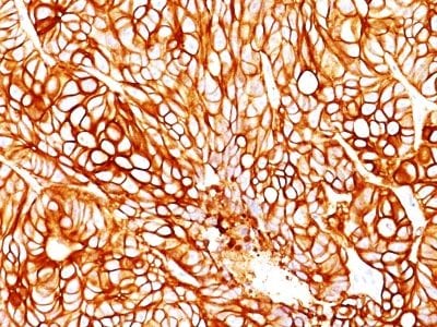Cytokeratin 18 Monoclonal Mouse Antibody (DA7)
