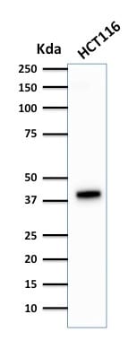 Cytokeratin 18 Monoclonal Mouse Antibody (DA7)