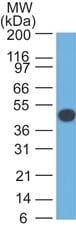 Cytokeratin 18 Monoclonal Mouse Antibody (DA7)