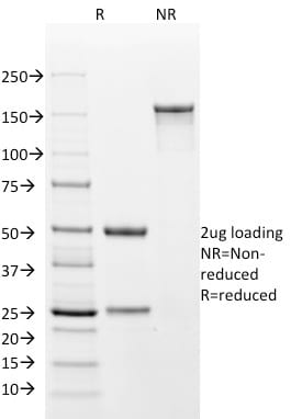 Cytokeratin 18 Monoclonal Mouse Antibody (DA7)