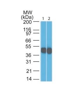 Cytokeratin 18 Monoclonal Mouse Antibody (DC10)