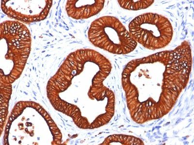 Cytokeratin 18 Monoclonal Mouse Antibody (DC10)