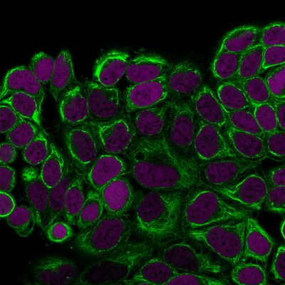 Cytokeratin 18 Monoclonal Mouse Antibody (DE-K18)