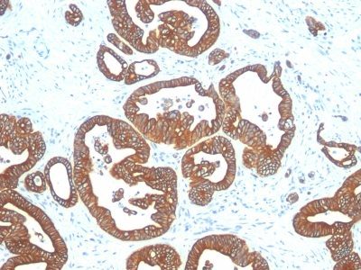 Cytokeratin 18 Monoclonal Mouse Antibody (DE-K18)