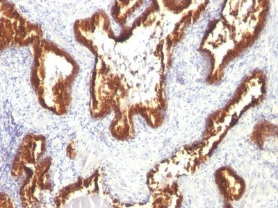 Cytokeratin 18 Monoclonal Mouse Antibody (KRT18/1190)