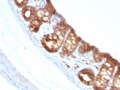 Cytokeratin 18 Monoclonal Mouse Antibody (KRT18/1190)