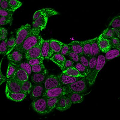 Cytokeratin 18 Monoclonal Mouse Antibody (KRT18/834)