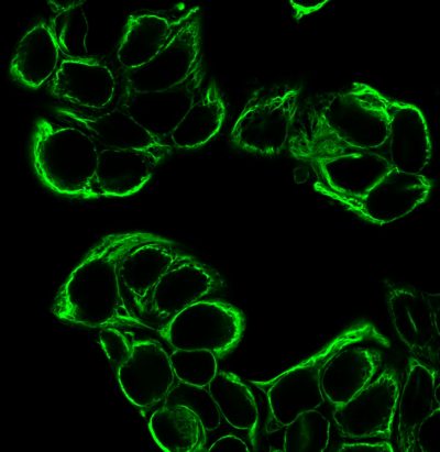 Cytokeratin 18 Monoclonal Mouse Antibody (KRT18/834)