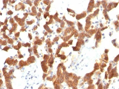 Cytokeratin 18 Monoclonal Mouse Antibody (KRT18/834)
