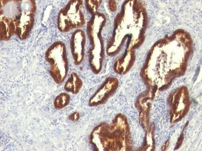Cytokeratin 18 Monoclonal Mouse Antibody (KRT18/834)